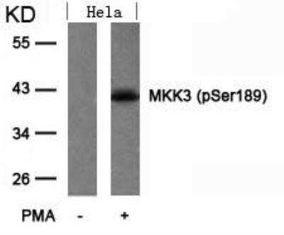 Western Blot: MKK3/MEK3 [p Ser189] Antibody [NB100-82048] - Analysis of extracts from Hela cells untreated or treated with PMA using MKK3(Phospho-Ser189) antibody